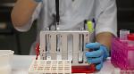 COVID-19 update: 20 persons found with the new mutant variant of SARS- CoV-2 virus COVID-19 update: 20 persons found with the new mutant variant of SARS- CoV-2 virus