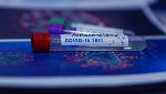 With over 18 crore tests, India registers unprecedented hike in Covid-19 testing With over 18 crore tests, India registers unprecedented hike in Covid-19 testing