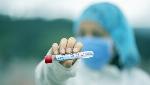 Covid-19 Update: In a landmark, India registers more than 200 million tests Covid-19 Update: In a landmark, India registers more than 200 million tests