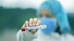 As COVID-19 cases spike again, Centre sends teams to 8 states to 'control transmission’ As COVID-19 cases spike again, Centre sends teams to 8 states to 'control transmission’