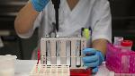 Top American pandemic expert lists 9 govt actions behind plummeting Covid-19 cases in India Top American pandemic expert lists 9 govt actions behind plummeting Covid-19 cases in India