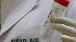 New saline gargle Covid-19 testing kit could be a boon for rural India New saline gargle Covid-19 testing kit could be a boon for rural India