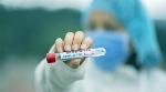 Covid-19 Update: India reports less than 1 lakh infections for 2nd consecutive day Covid-19 Update: India reports less than 1 lakh infections for 2nd consecutive day