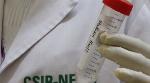 India’s research institute develops saline gargle RT-PCR technique India’s research institute develops saline gargle RT-PCR technique